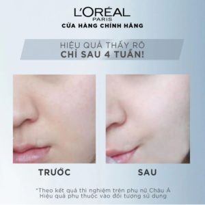 Alternative view of TINH CHẤT TĂNG CƯỜNG DƯỠNG DA TRẮNG MỊN & GIẢM THÂM NÁM L'OREAL PARIS AURA PERFECT CLINICAL 30ml